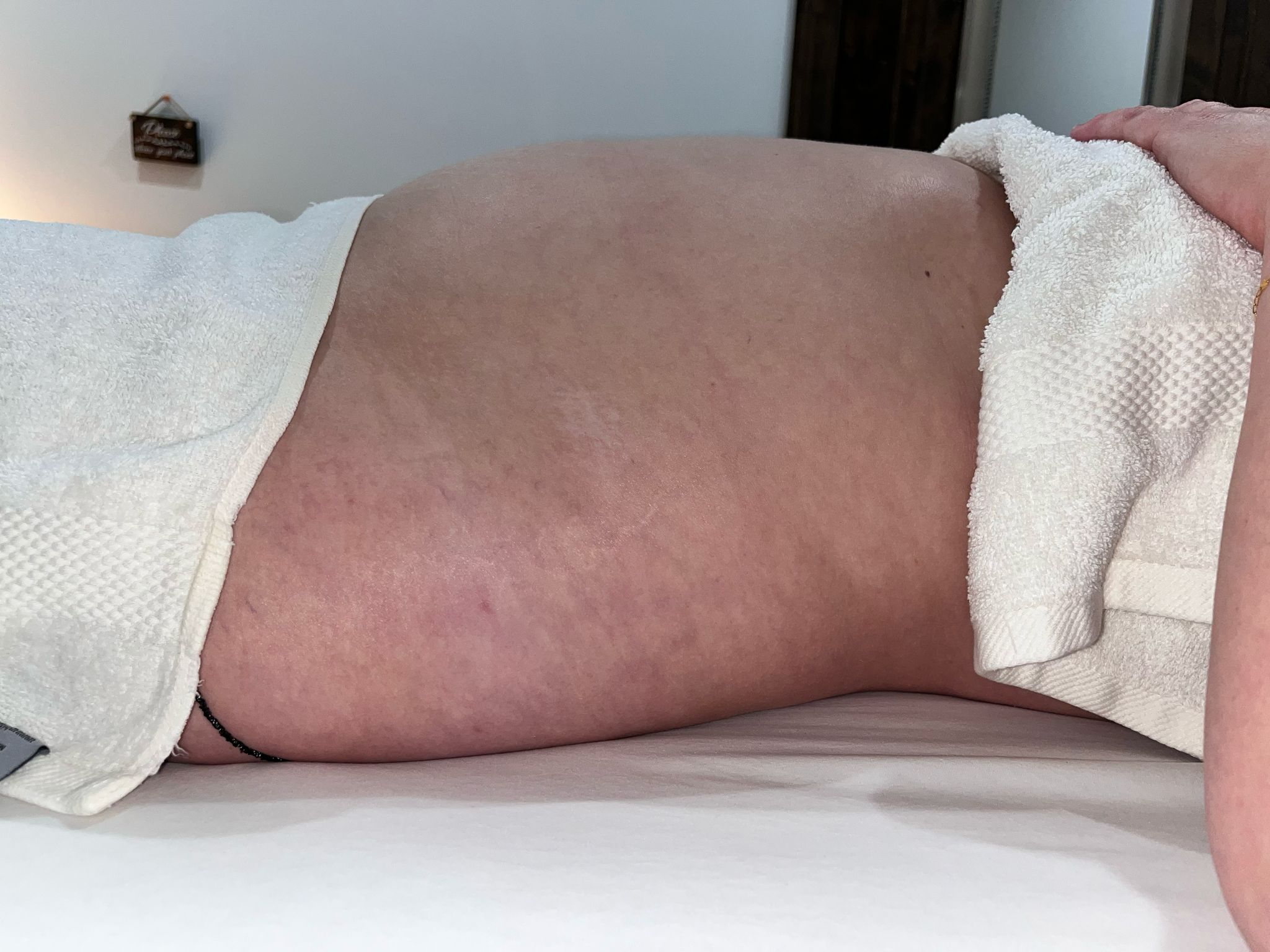 Before treatment