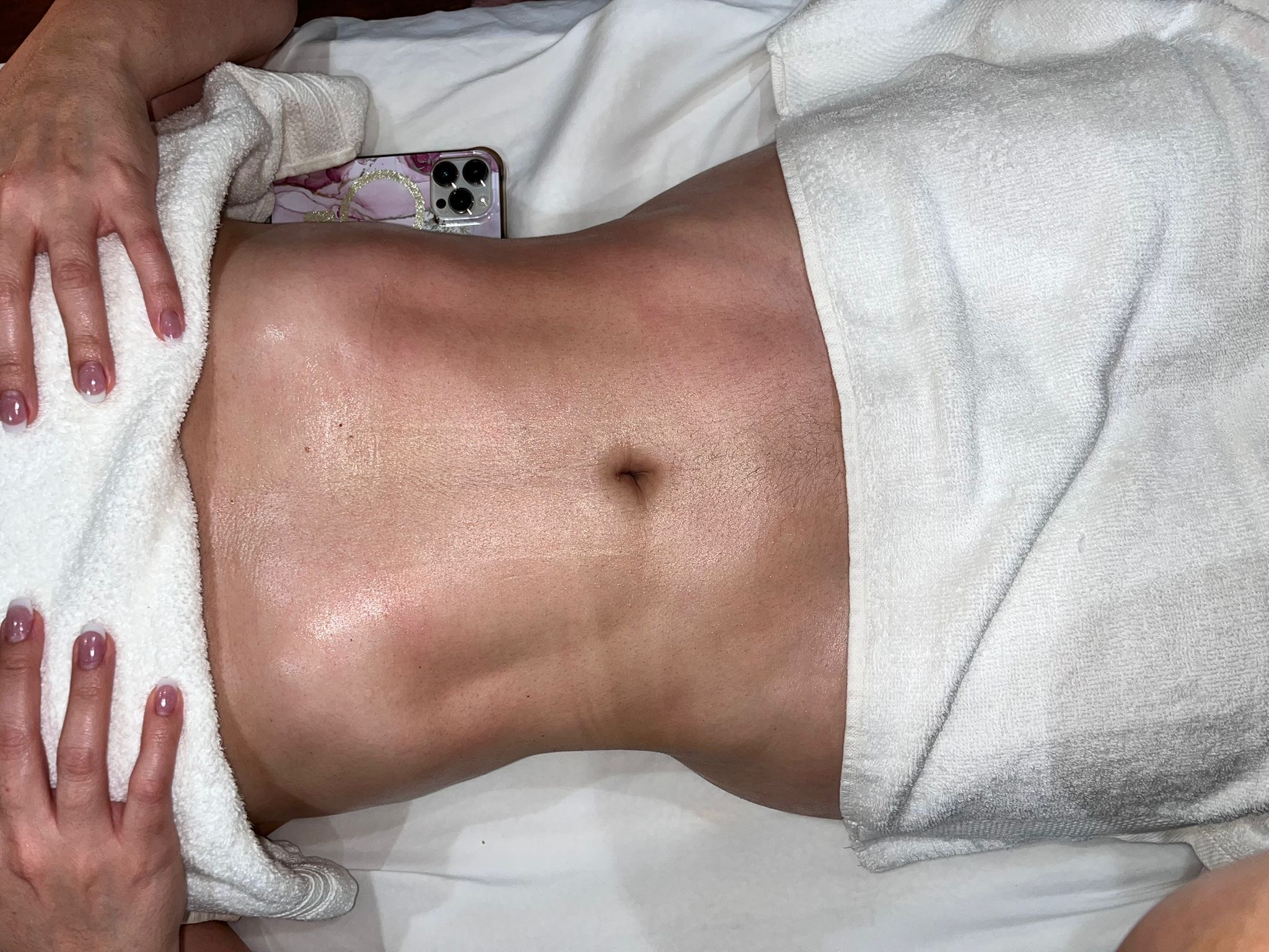 After treatment