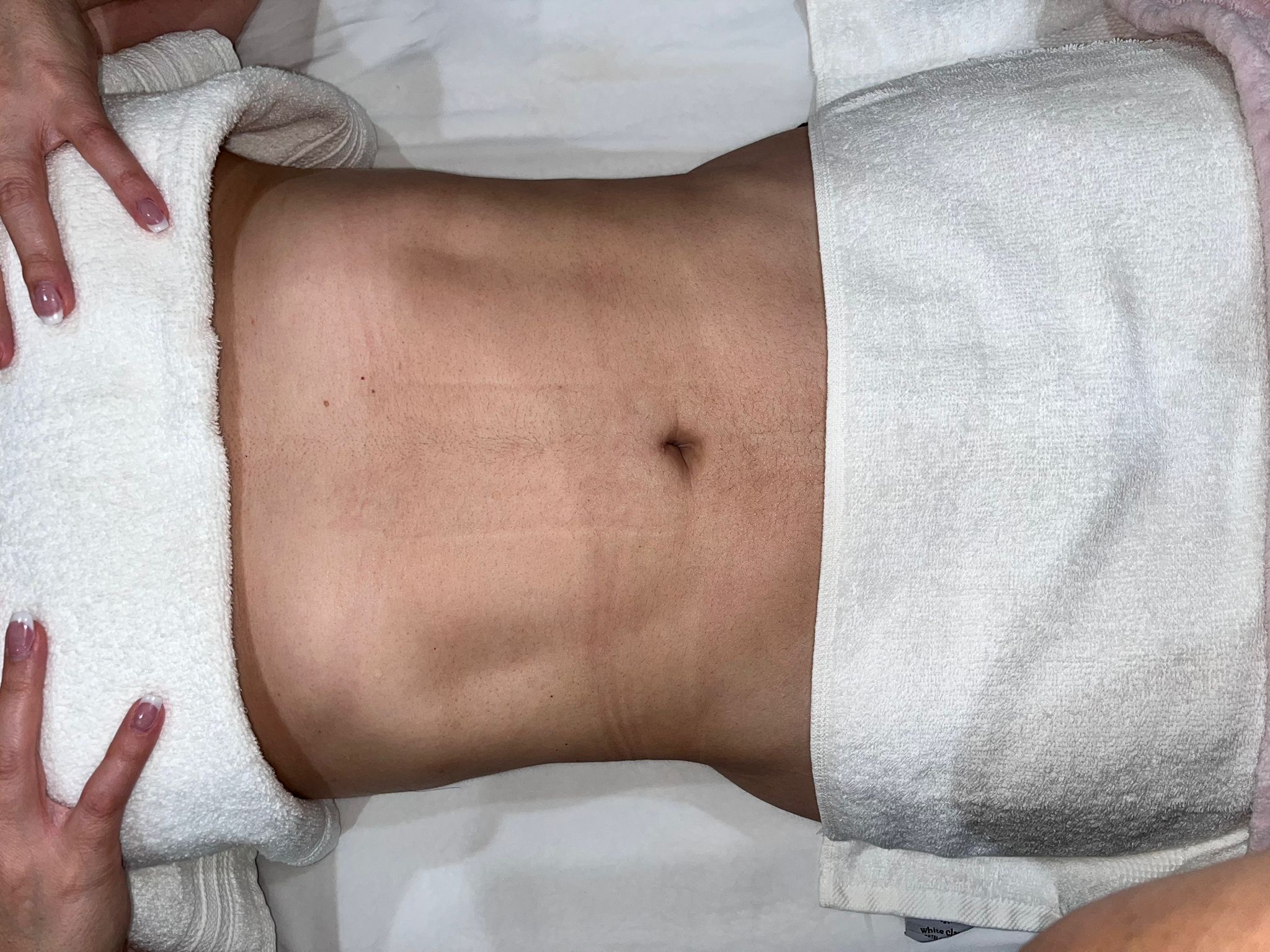 Before treatment